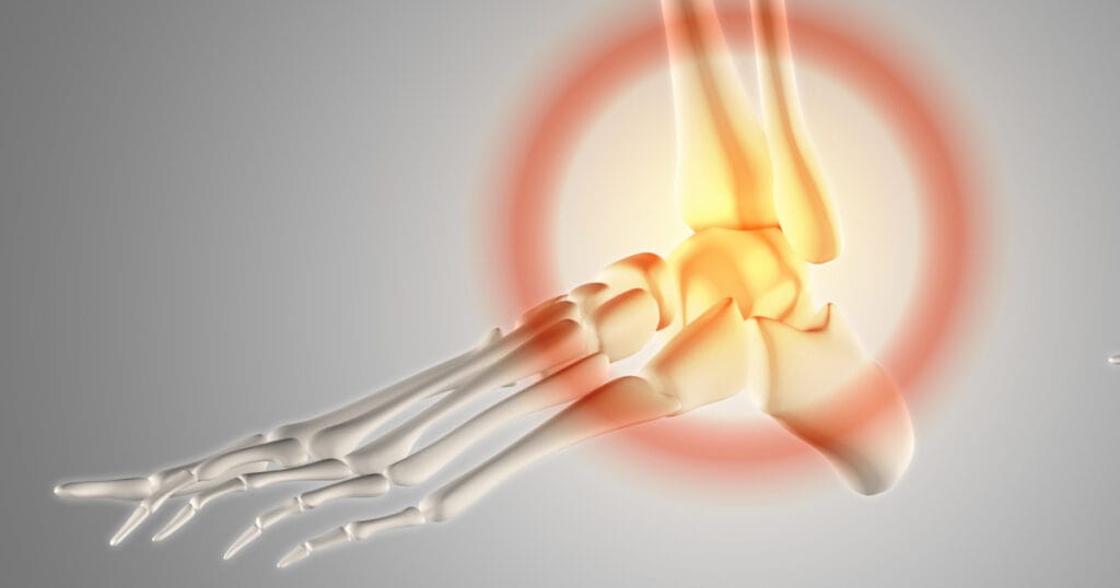 Ayak Bileği Yaralanmaları