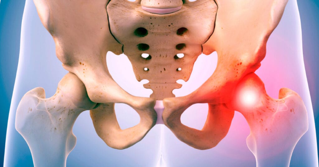 Eklem Koruyucu Cerrahi