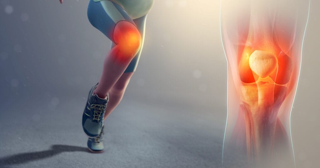 Patellofemoral Problemler