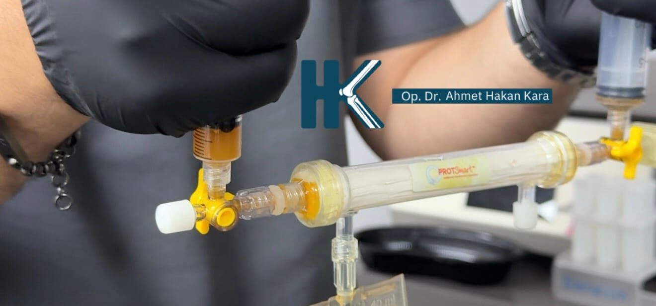 Alpha-2 Makroglobulin