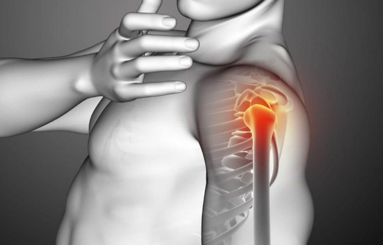 omuz-yaralanmalari-001