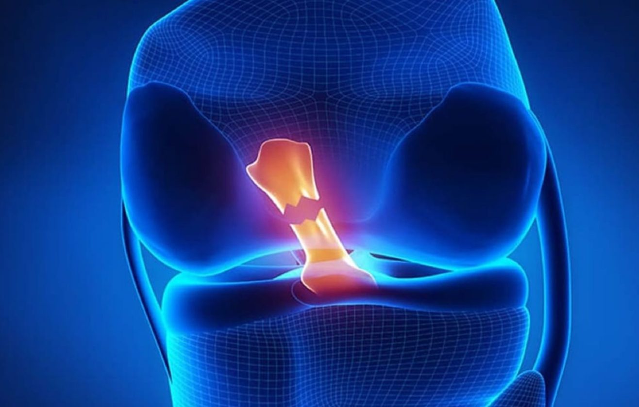 on-capraz-bag-yaralanmasi-02