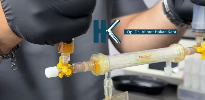 Alpha 2 Makroglobulin