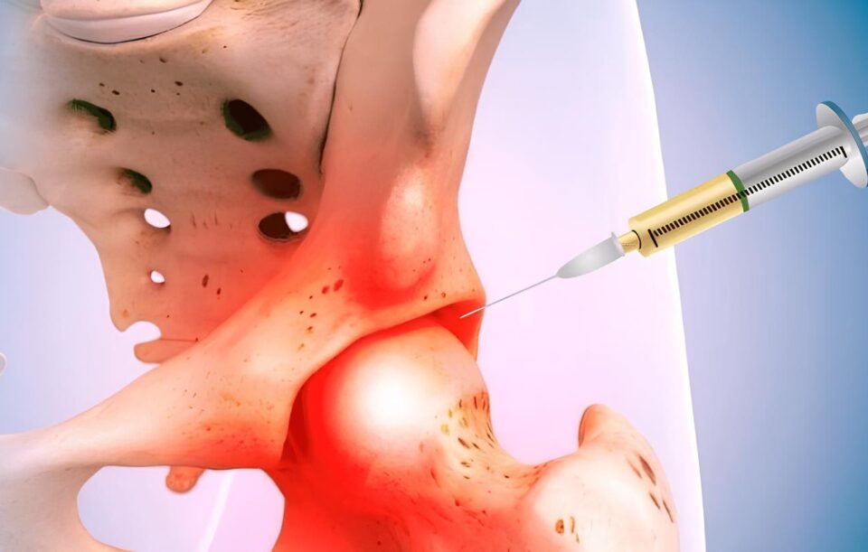 Kalça Eklem Enjeksiyonu