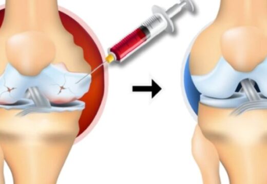 Kök Hücre Tedavisi